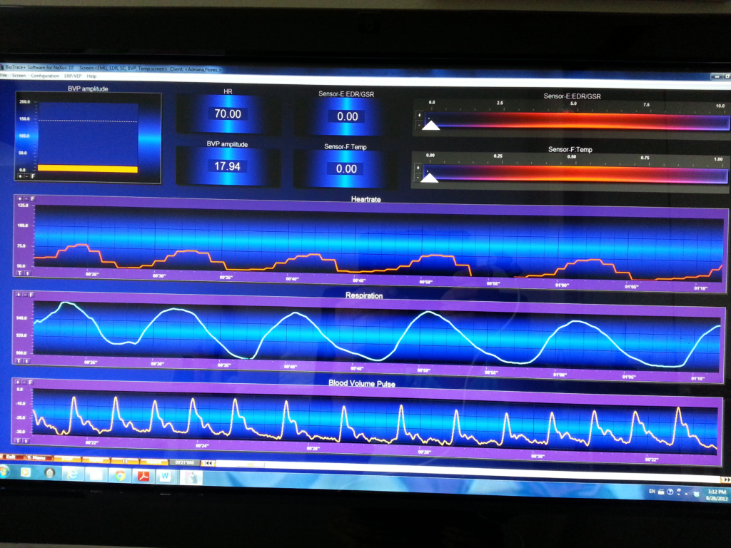 Biofeedback. Flores Psychobehavioral Services. Pleasanton, CA.